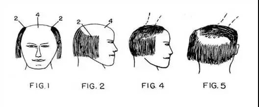 五款防止脫發(fā)的“正經(jīng)”專利！