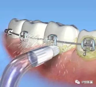 「專利技術(shù)」助您保護口腔衛(wèi)生