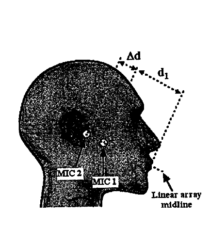 關(guān)于Jawbone Innovations, LLC海外專利糾紛高頻原告的風(fēng)險(xiǎn)預(yù)警