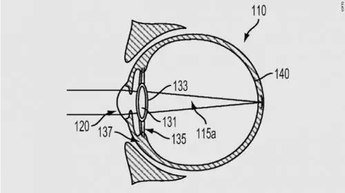 科技 | 谷歌把“電子眼注入眼球”，專利申請能否通過？